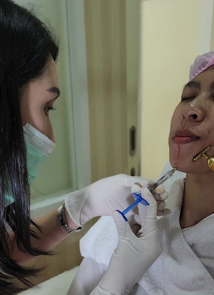 Filler dagu Jakarta dilakukan oleh dokter di Ovela Clinic