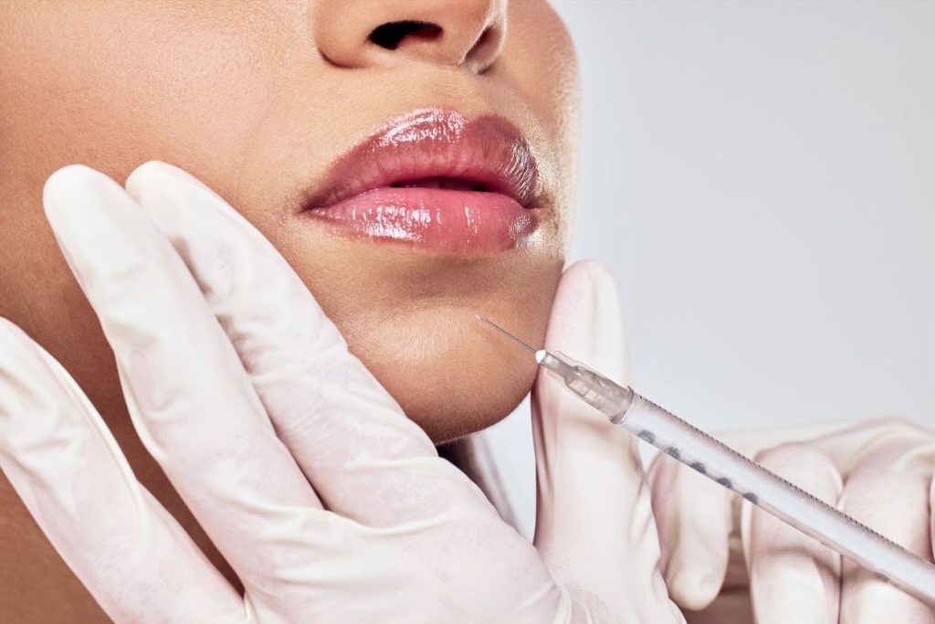Chin filler treatment untuk membantu memperbaiki contour dan proporsi wajah di Ovela Clinic Jakarta