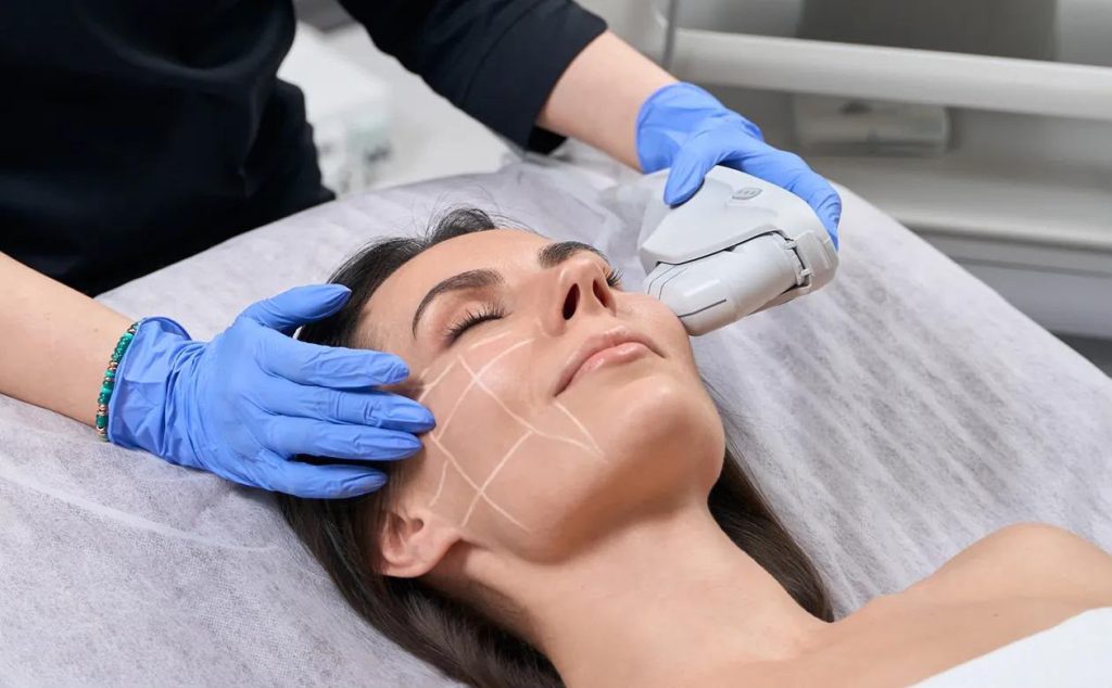 harga ultherapy