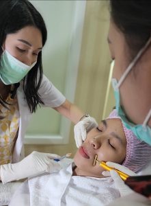 Filler garis senyum Jakarta dilakukan oleh dokter di Ovela Clinic