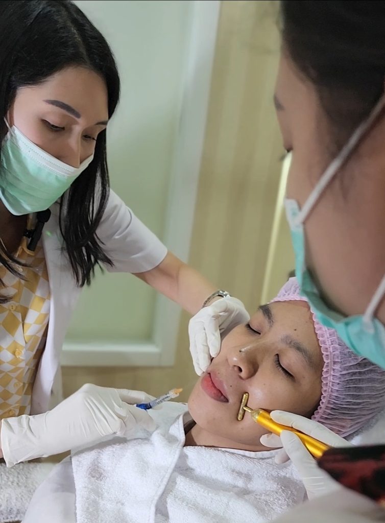 Prosedur filler garis senyum pada area nasolabial fold di Ovela Clinic Jakarta